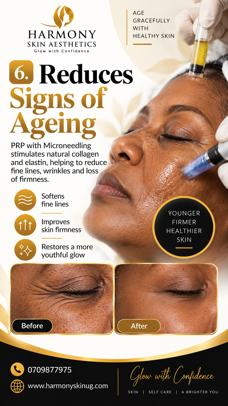 Signs of aging?